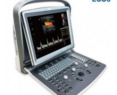 CHISON  ECO 6